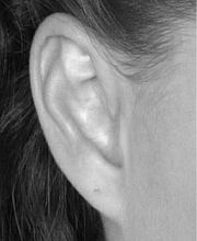 Natalie Portman: Ohr