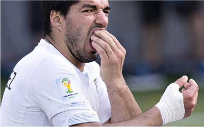 Luis ‚Vampir’ Suarez – selbst in die Hand gebissen?